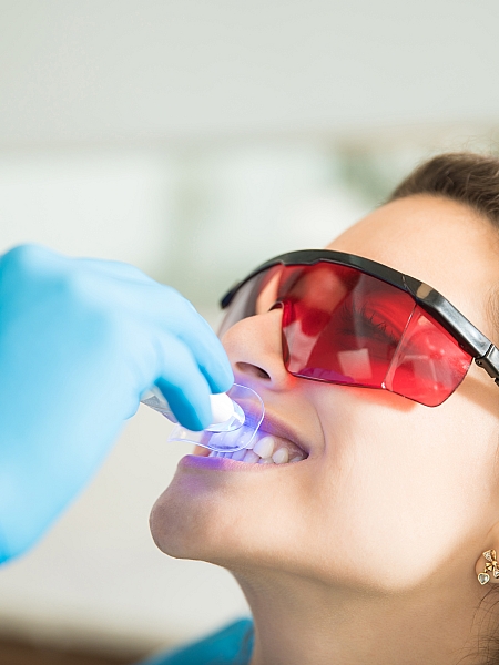 Diş Beyazlatma Uygulamaları