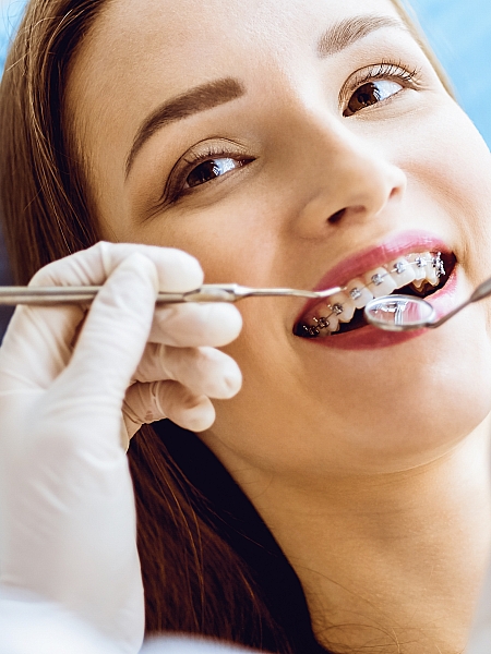 Diş Teli Tedavisi Uygulamaları