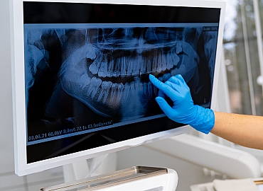 Dijital Diş Hekimliği 3